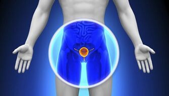 Behandlung vun der Prostatitis mat Drogen
