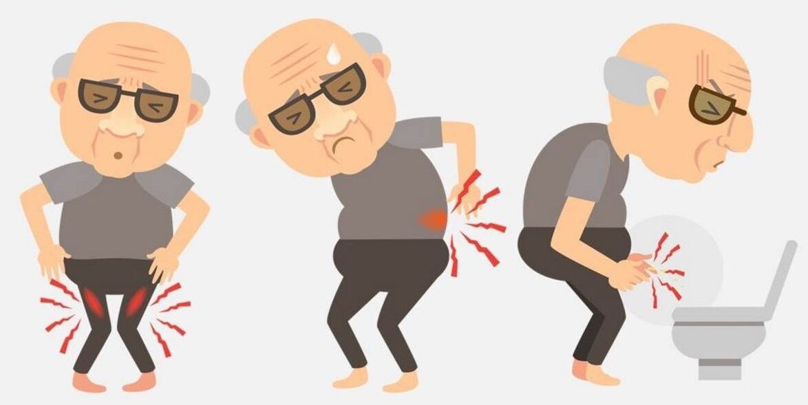 Symptomer vun prostatitis