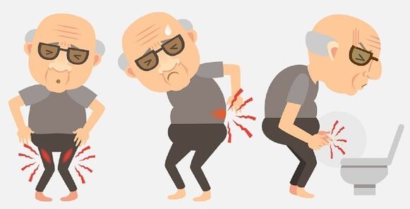 Symptomer vun der Prostatitis a seng Behandlung mat Drogen